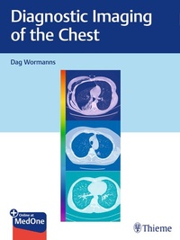 Abbildung von: Diagnostic Imaging of the Chest - Thieme