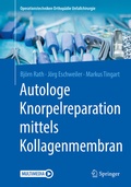 Cover: Autologe Knorpelreparation mittels Kollagenmembran - Springer