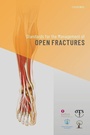 Cover: Standards for the Management of Open Fractures - Oxford University Press