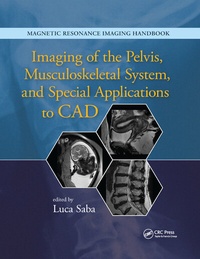 Enlarge image Cover: Imaging of the Pelvis, Musculoskeletal System, and Special Applications to CAD - CRC Press