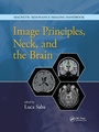 Cover: Image Principles, Neck, and the Brain - CRC Press