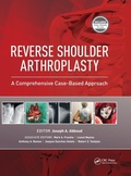 Cover: Reverse Shoulder Arthroplasty - SLACK  Incorporated