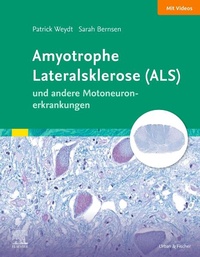 Abbildung von: Amyotrophe Lateralsklerose (ALS) und andere Motoneuronerkrankungen - Urban & Fischer