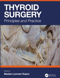 Abbildung von: Thyroid Surgery - CRC Press