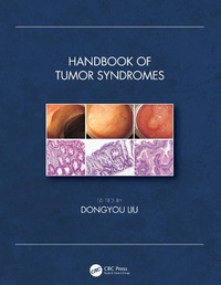 Abbildung von: Handbook of Tumor Syndromes - CRC Press