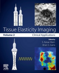 Enlarge image Cover: Tissue Elasticity Imaging - Elsevier