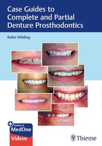 Abbildung von: Case Guides to Complete and Partial Denture Prosthodontics - Thieme Publishers