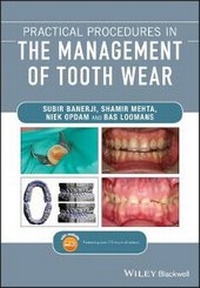 Enlarge image Cover: Practical Procedures in the Management of Tooth Wear - Wiley