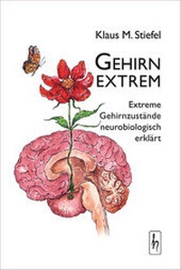 Abbildung von: Gehirn extrem - Hübner, Felicitas