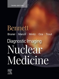 Abbildung von: Diagnostic Imaging: Nuclear Medicine E-Book - Elsevier