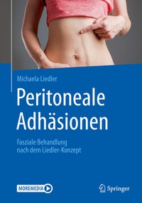 Abbildung von: Peritoneale Adhäsionen - Springer