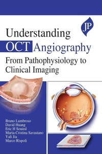 Enlarge image Cover: Understanding OCT Angiography - JP Medical Ltd