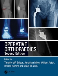 Enlarge image Cover: Operative Orthopaedics - CRC Press