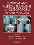 Cover: Surgical and Medical Treatment of Osteoporosis - CRC Press