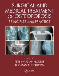 Abbildung von: Surgical and Medical Treatment of Osteoporosis - CRC Press
