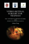 Cover: Vitreoretinal Surgery for Trainees- The University of British Columbia and Sydney Eye Hospital Manual - Lulu.com