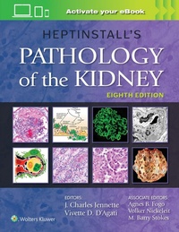Abbildung von: Heptinstall's Pathology of the Kidney - WOLTERS KLUWER HEALTH