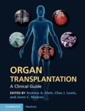 Cover: Organ Transplantation - Cambridge University Press