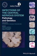 Abbildung von: Infections of the Central Nervous System - Wiley