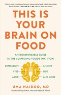 Abbildung von: This Is Your Brain on Food - Little, Brown and Company