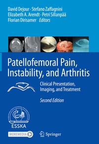 Abbildung von: Patellofemoral Pain, Instability, and Arthritis - Springer