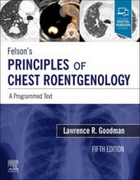 Abbildung von: Felson's Principles of Chest Roentgenology E-Book - Elsevier