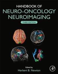 Abbildung von: Handbook of Neuro-Oncology Neuroimaging - Academic Press