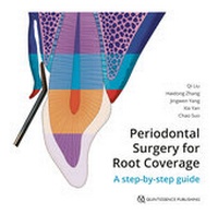 Abbildung von: Periodontal Surgery for Root Coverage - Quintessenz Verlags GmbH