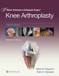 Cover: Master Techniques in Orthopedic Surgery: Knee Arthroplasty - Wolters Kluwer Health