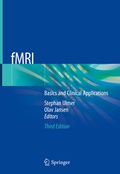 Abbildung von: fMRI - Springer
