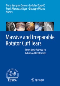 Abbildung von: Massive and Irreparable Rotator Cuff Tears - Springer