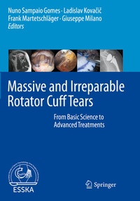 Abbildung von: Massive and Irreparable Rotator Cuff Tears - Springer