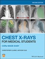 Cover: Chest X-Rays for Medical Students - Wiley