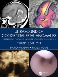 Abbildung von: Ultrasound of Congenital Fetal Anomalies - CRC Press