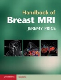 Abbildung von: Handbook of Breast MRI - Cambridge University Press