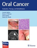 Cover: Oral Cancer - Thieme Publishers