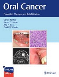 Enlarge image Cover: Oral Cancer - Thieme Publishers