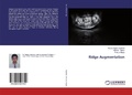 Cover: Ridge Augmentation - LAP Lambert Academic Publishing