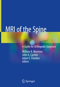 Cover: MRI of the Spine - Springer