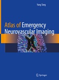 Cover: Atlas of Emergency Neurovascular Imaging - Springer