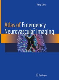 Abbildung von: Atlas of Emergency Neurovascular Imaging - Springer