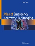 Cover: Atlas of Emergency Neurovascular Imaging - Springer