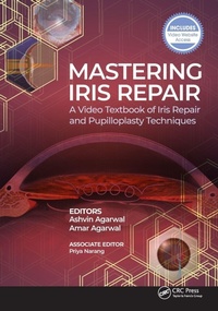 Enlarge image Cover: Mastering Iris Repair - SLACK Incorporated