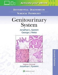 Abbildung von: Differential Diagnoses in Surgical Pathology: Genitourinary System - WOLTERS KLUWER HEALTH