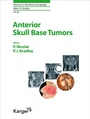 Cover: Anterior Skull Base Tumors - Karger, S