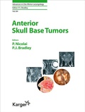 Cover: Anterior Skull Base Tumors - Karger, S