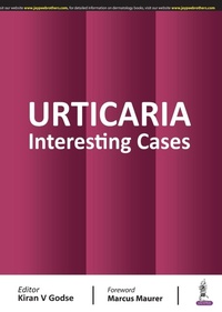 Enlarge image Cover: Urticaria - Jaypee Brothers Medical Publishers