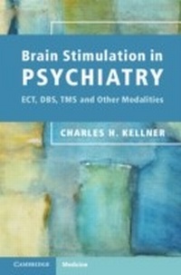 Bild: Brain Stimulation in Psychiatry - Cambridge University Press