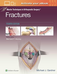 Abbildung von: Master Techniques in Orthopaedic Surgery: Fractures - WOLTERS KLUWER HEALTH