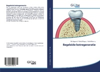 Abbildung von: Begeleide botregeneratie - GlobeEdit
